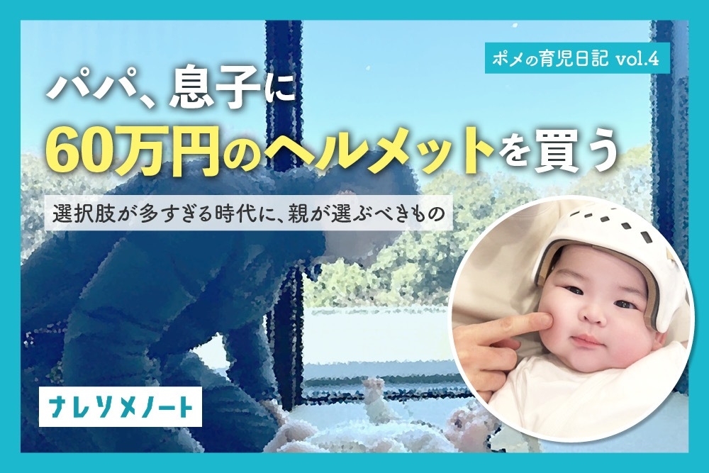【ポメの育休日記 vol.4】赤ちゃんの頭の形、治すべき? ヘルメット治療の必要性や費用を経験者が語る